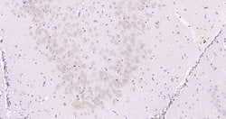 ABH1/ALKB Rabbit anti-Human, Polyclonal, Bioss 100 &mu;L; Unconjugated:Antibodies,