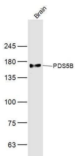PDS5B Rabbit anti-Human, Polyclonal, Bioss 100 &mu;L; Unconjugated:Antibodies,