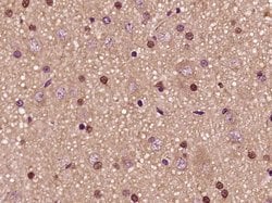 PFKFB3/PFK2 Rabbit anti-Human, Polyclonal, Bioss 100 &mu;L; Unconjugated:Antibodies,