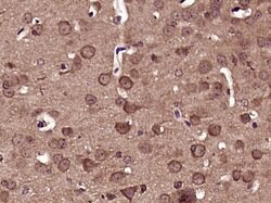 Phospho-DRP1 (Ser616) Rabbit anti-Human, Polyclonal, Bioss 100 &mu;L; Unconjugated:Antibodies,