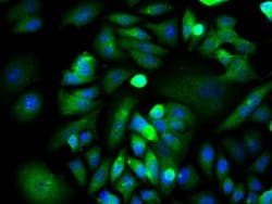 XIAP/BIRC4 Rabbit anti-Human, Polyclonal, Bioss 100 &mu;L; Unconjugated:Antibodies,