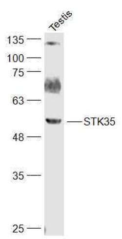 STK35 Rabbit anti-Human, Polyclonal, Bioss 100 &mu;L; Unconjugated:Antibodies,