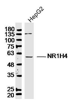 Bile Acid Receptor NR1H4 Rabbit anti-Human, Polyclonal, Bioss 100 &mu;L;