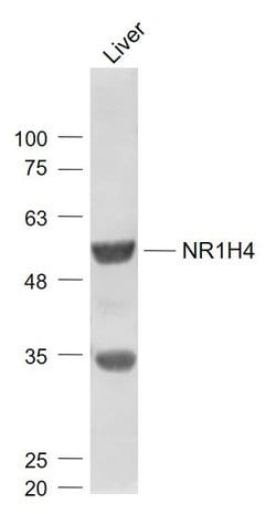 Bile Acid Receptor NR1H4 Rabbit anti-Human, Polyclonal, Bioss 100 &mu;L;