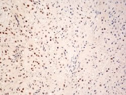 Phospho-c-Fos (Ser362) Rabbit anti-Human, Polyclonal, Bioss 100 &mu;L;