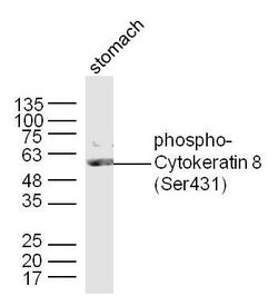 Phospho-Cytokeratin 8 (Ser431) Rabbit anti-Human, Polyclonal, Bioss 100