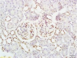Defensin beta 2/DEFB2/HBD-2 Rabbit anti-Mouse, Polyclonal, Bioss 100 &mu;L;