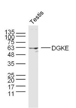 DGKE Rabbit anti-Human, Polyclonal, Bioss 100 &mu;L | Buy Online | Bioss | Fisher Scientific