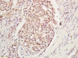 DNA Polymerase gamma Rabbit anti-Human, Polyclonal, Bioss 100 &mu;L; Unconjugated:Antibodies,