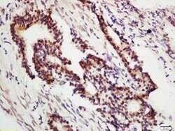 DNA Polymerase gamma Rabbit anti-Human, Polyclonal, Bioss 100 &mu;L; Unconjugated:Antibodies,
