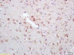 GAD67/GAD1 Rabbit anti-Human, Polyclonal, Bioss 100 &mu;L; Unconjugated:Antibodies,