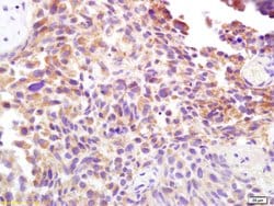 CD138/Syndecan 1 Rabbit anti-Human, Polyclonal, Bioss 100 &mu;L; Unconjugated:Antibodies,