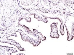 CD138/Syndecan 1 Rabbit anti-Human, Polyclonal, Bioss 100 &mu;L; Unconjugated:Antibodies,