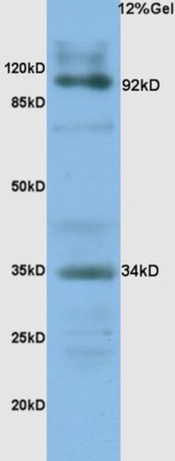 CD138/Syndecan 1 Rabbit anti-Human, Polyclonal, Bioss 100 &mu;L; Unconjugated:Antibodies,