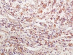 EPS15R Rabbit anti-Human, Polyclonal, Bioss 100 &mu;L; Unconjugated:Antibodies,