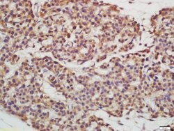 EPS15R Rabbit anti-Human, Polyclonal, Bioss 100 &mu;L; Unconjugated:Antibodies,