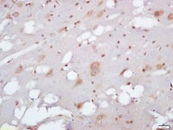 EXOC2/SEC5 Rabbit anti-Human, Polyclonal, Bioss 100 &mu;L; Unconjugated:Antibodies,