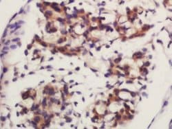 Frizzled 4/CD344 Rabbit anti-Human, Polyclonal, Bioss 100 &mu;L; Unconjugated:Antibodies,