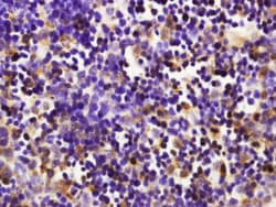 Furin Rabbit anti-Human, Polyclonal, Bioss 100 &mu;L; Unconjugated:Antibodies,
