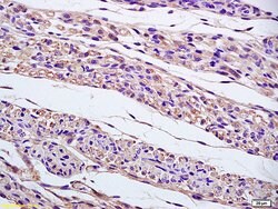 gamma tubulin Centrosome Marker Rabbit anti-Human, Polyclonal, Bioss 100