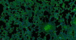 GAA Rabbit anti-Human, Polyclonal, Bioss 100 &mu;L; Unconjugated:Antibodies,