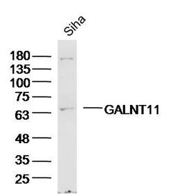 GALNT11/GalNAc-T11 Rabbit anti-Human, Polyclonal, Bioss 100 &mu;L; Unconjugated:Antibodies,