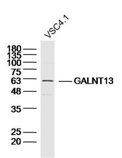 GALNT13/GalNAc-T13 Rabbit anti-Human, Polyclonal, Bioss 100 &mu;L; Unconjugated:Antibodies,