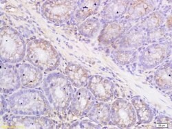 Metallothionein Rabbit anti-Human, Polyclonal, Bioss 100 &mu;L; Unconjugated:Antibodies,