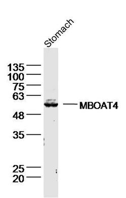 MBOAT4/Ghrelin O acyltransferase Rabbit anti-Human, Polyclonal, Bioss 100