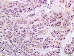 Notch1/MOTC Rabbit anti-Human, Polyclonal, Bioss 100 &mu;L; Unconjugated:Antibodies,