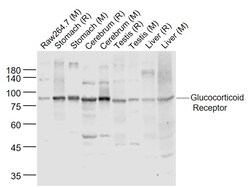 Glucocorticoid Receptor beta Polyclonal Antibody, Bioss 100 &mu;L | Buy Online | Bioss | Fisher Scientific