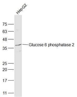 Glucose 6 phosphatase 2/IGRP Rabbit anti-Human, Polyclonal, Bioss 100 &mu;L;