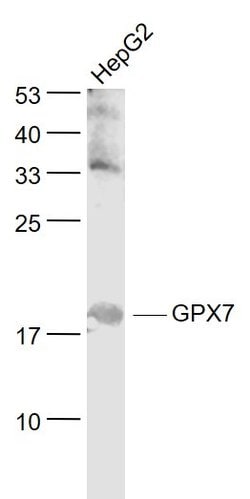 GPX7/Glutathione Peroxidase 7 Rabbit anti-Human, Polyclonal, Bioss 100