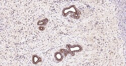 CK18 Polyclonal Antibody, Bioss 100 &mu;L; Unconjugated:Antibodies, Polyclonal