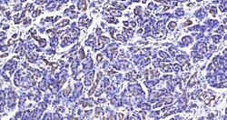 CK18 Polyclonal Antibody, Bioss 100 &mu;L; Unconjugated:Antibodies, Polyclonal