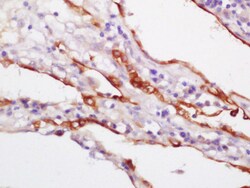 CK18 Polyclonal Antibody, Bioss 100 &mu;L; Unconjugated:Antibodies, Polyclonal