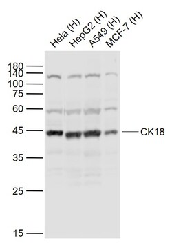 CK18 Polyclonal Antibody, Bioss 100 &mu;L; Unconjugated:Antibodies, Polyclonal