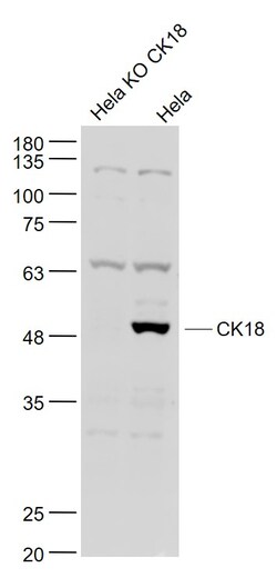 CK18 Polyclonal Antibody, Bioss 100 &mu;L; Unconjugated:Antibodies, Polyclonal