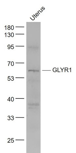 GLYR1/NP60 Rabbit anti-Human, Polyclonal, Bioss 100 &mu;L; Unconjugated:Antibodies,