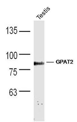 GPAT2 Rabbit anti-Human, Polyclonal, Bioss 100 &mu;L; Unconjugated:Antibodies,