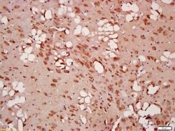 Beclin 1 Rabbit anti-Human, Polyclonal, Bioss 100 &mu;L; Unconjugated:Antibodies,