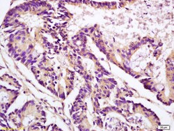Apolipoprotein J Rabbit anti-Human, Polyclonal, Bioss 100 &mu;L; Unconjugated:Antibodies,