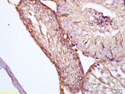 Apolipoprotein J Rabbit anti-Human, Polyclonal, Bioss 100 &mu;L; Unconjugated:Antibodies,