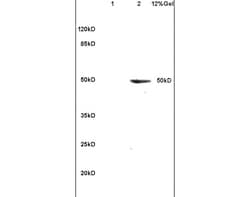 Apolipoprotein J Rabbit anti-Human, Polyclonal, Bioss 100 &mu;L; Unconjugated:Antibodies,