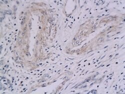 Integrin Alpha V + Beta 5 Rabbit anti-Human Mouse Rat, Polyclonal, Bioss