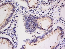 Integrin Alpha V + Beta 5 Rabbit anti-Human Mouse Rat, Polyclonal, Bioss