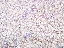 Integrin Alpha V + Beta 5 Rabbit anti-Human Mouse Rat, Polyclonal, Bioss