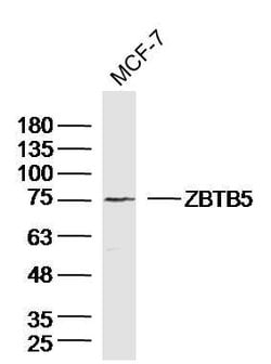 ZBTB5 Rabbit anti-Human, Polyclonal, Bioss 100 &mu;L; Unconjugated:Antibodies,