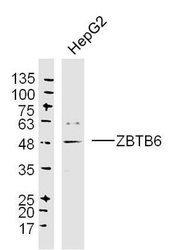 ZBTB6/ZNF482 Rabbit anti-Human, Polyclonal, Bioss 100 &mu;L; Unconjugated:Antibodies,