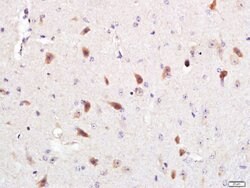 Optineurin Rabbit anti-Human, Polyclonal, Bioss 100 &mu;L; Unconjugated:Antibodies,